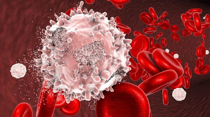 Mejora de la comprensión del mantenimiento del fenotipo de la leucemia aguda linfoblástica